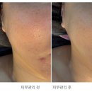 아리스민