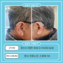 조은소리보청기유성점 | 대전 유성구 보청기,정XX 고객님 포낙 인피니오 스피어 90 구매후기(60대,男)