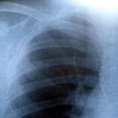 서울역한의원 이미지