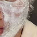 명동 리쥬란힐러 미술관 피부과에서 크라이오셀 솔직 후기