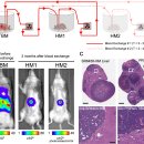 Re: 0기 유방암(ductal carcinoma in situ) '이미 circulating tumor cell을 내보내고 있다!! 이미지