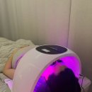 [공지] 엘루엔에스테틱 부천점 스킨스케일링 LDM물방울리프팅 후기