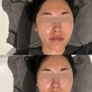 뷰-티나(뷰-Tina) | 끌리메 목포점 / 예비신부의 작은얼굴관리 솔직후기 / 끌리메 작은 얼굴관리 / 목포 얼굴관리 / 목포...