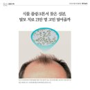 거창 인셀덤