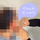 더리프트의원 | 울산 안면거상술 후기｜60대 얼굴 처짐 개선, 자연스러운 동안 효과의 MACS 리프트