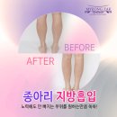 명작의원 이미지