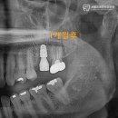 광명치과기공소 이미지