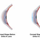 드림안경 콘택트 이미지