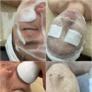 [춘천 피부관리] G&amp;N뷰티 에스테틱 리얼 후기! 피부 윤곽+두피 테라피 완벽 케어
