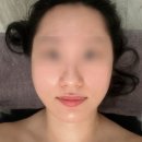 고은피부만들기 | [건대] 광대부자도 매끈해지는 결이고은 건대피부관리 받고 온 후기