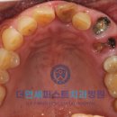 더연세퍼스트치과병원 이미지