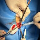 MS동물병원 | 전두동 종양에서 방사선 치료까지: 두개강 침습을 막기 위한 결정적 치료 전략