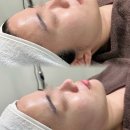 하이프팅 관리 리얼후기! 유아즈뷰티에서 받은 잠실리프팅 리얼후기