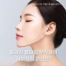 중앙사진실 - 원주시 원일로 98 | 울쎄라? 볼패임 부작용 없이 갸름 탱탱해지는 법