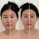 평택합정SKVIEW 주상복합 | 평택피부관리 밀도뷰티랩 평택｜테라노바 상체전면·얼굴관리로 뱃살부터 승모근까지