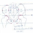 골반의 X선 진단 이미지