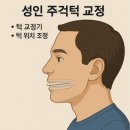 강인수양휘치과의원 | 성인주걱턱교정, 수술도 발치도 안했어요