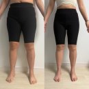 (주)무한 | 허벅지 무한람스 후기 5주차, 승마살주사 허벅지 붓기 변화