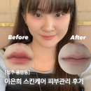 [청주 용암동] 이은희 스킨케어에서 피부관리 받은 후기