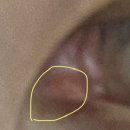 서울중앙안과의원 이미지