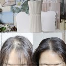 렌즈미안양1번가점 | 두피앰플 다노날 두피세럼 한달 사용후기 각질케어로도 딱이네