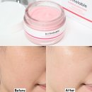 맑은약국 | 메라블 루비알엔 피코샷 기미크림 일주일 후기, 약국 입점 기미 케어