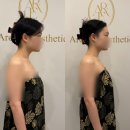 아로멍 | 대구 수성구피부관리 &#34;아로엘라&#34; 솔직한 후기(+가성비 웨딩관리)