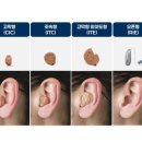 벨톤보청기 이천지사 이미지