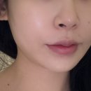 유리알스킨 | 풍무동 피부관리 이끌림스킨앤바디 유리알케어로 출산 후 여름피부케어 후기