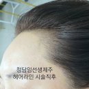 김헤어라인 이미지