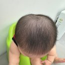 아이사랑두헬멧 대전센터 | 사두증 단두증 교정 세종 지오헬멧 ( 두상스캔검사 | 교정전후과정 | 헬멧교정완료)