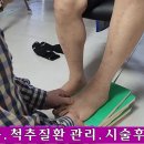 무릎의 통증의 원인은 무엇인가 이미지