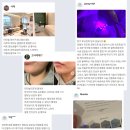 우아한피부과의원 티스토리