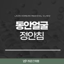정안 티스토리