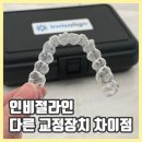인비절라인 가격부터 장단점까지, 일반 교정장치와 다른점은?