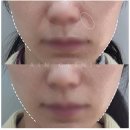 피오르의원 이미지