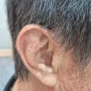 보청기 매니저 | 부천 보청기 보조금 안내, 누구에게나 가능한가요?