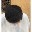 비어있던 정수리를 자신감으로 채우다: 2021년부터 시작된 김해 단골 고객의 탈모교정펌 이야기 이미지