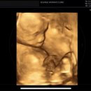 세상의반여성의원 이미지