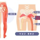 이상근 티스토리