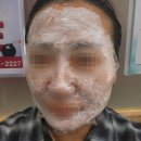 한사랑 | 한사랑피부과 셀라스 후기 + 재생크림 추천｜하라셀 레이셀크림 내돈내산