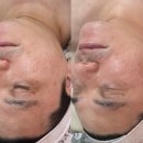 노진희피부연구소