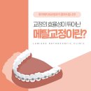 루미에치과교정과치과의원 네이버블로그