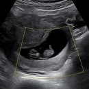 케이씨엠 KCM 이미지