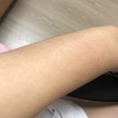 뷰티포톤피아 부천 상동 팔 알라딘필링 후기