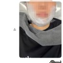 준한의원 | 전남광주 피부관리 모리프한의원 상무점 상담 + 울쎄라, 볼뉴머 시술 후기