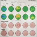유동밧데리 | 동탄 디딤정신의학과 9세 초등학생 풀배터리 검사 결과 후기