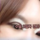 비씨아이성형외과의원 네이버블로그