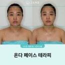 동아에스티(주)창원지점 | 창원 웨딩관리 | 자극없는 온.다웨이브 리프팅후기 | 고운빛깔 상남점