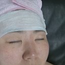 여우늘 | 수진역피부 추천, 염증완화 플라즈마케어 후기 예쁜여우뷰티